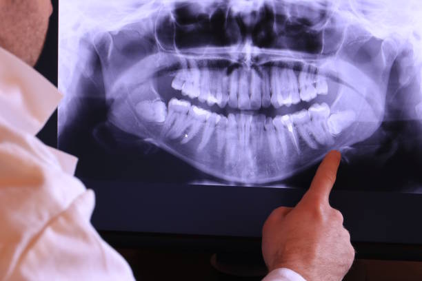Best Walk-In Emergency Dentist in Westmont, CA